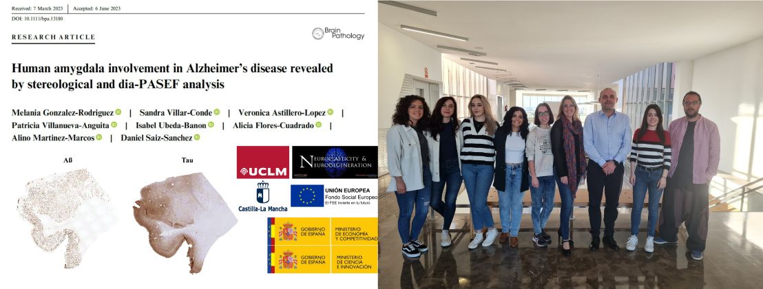 Publicacion del grupo de Neuroplasticidad y Neurodegeneración 